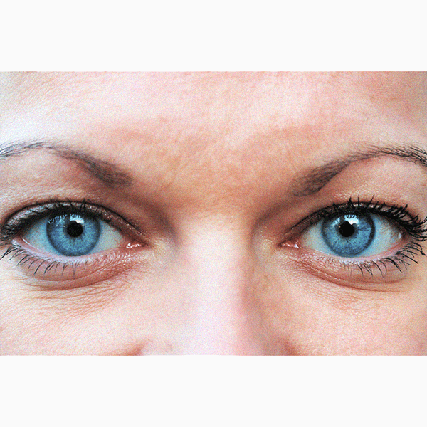 Можно ли распознать болезнь по глазам? Объясняет невролог
