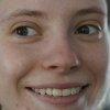 Пигментация на лице после загара: почему появляется и что делать?