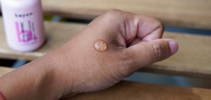 В каких продуктах содержится гиалуроновая кислота