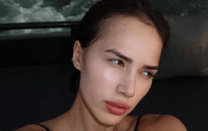 Алину Загитову обвинили в злоупотреблении уколами красоты