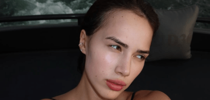 Алину Загитову обвинили в злоупотреблении уколами красоты