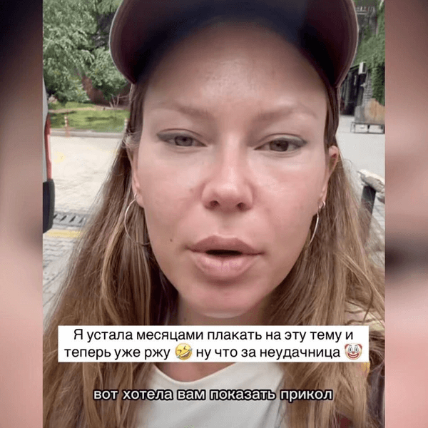 Рита Дакота откровенно рассказала о последствиях неудачной пластики