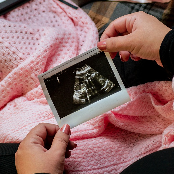 что показывает ктг плода