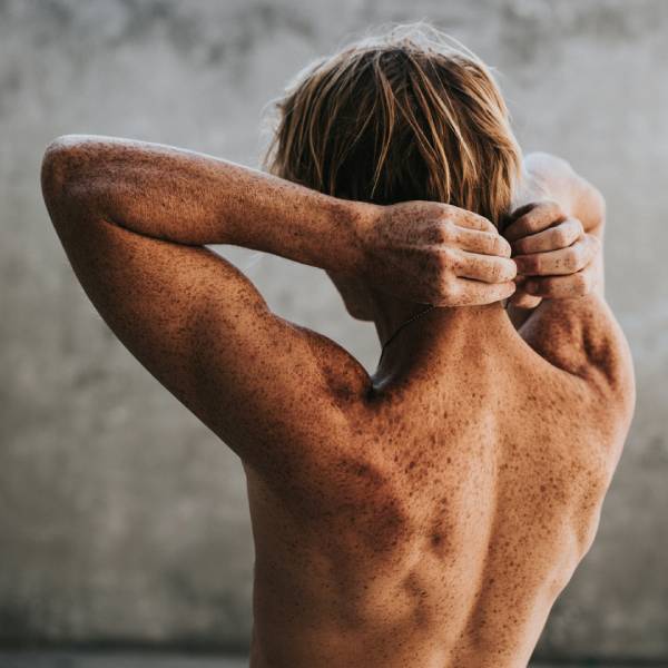 ихтиоз у человека