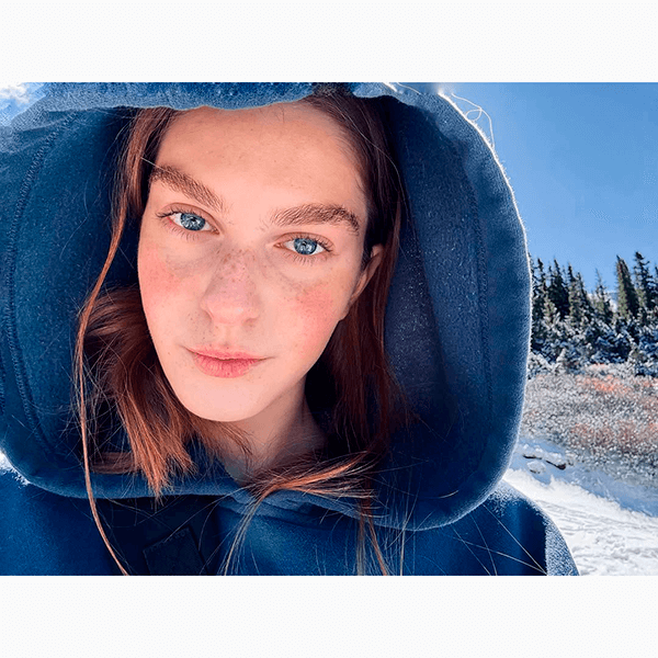 Какие кислоты в косметике пригодятся вам в уходе за кожей этой зимой?