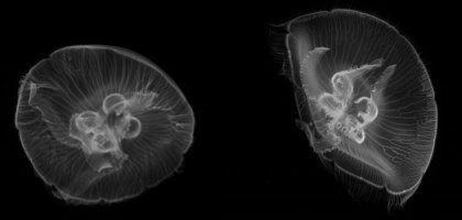 Что делать, если ужалила медуза в море: первая помощь