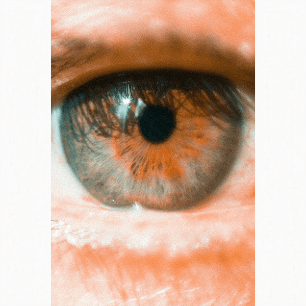 5 симптомов инсульта, которые легко спутать с усталостью, опьянением и другими состояниями: рассказывает невролог