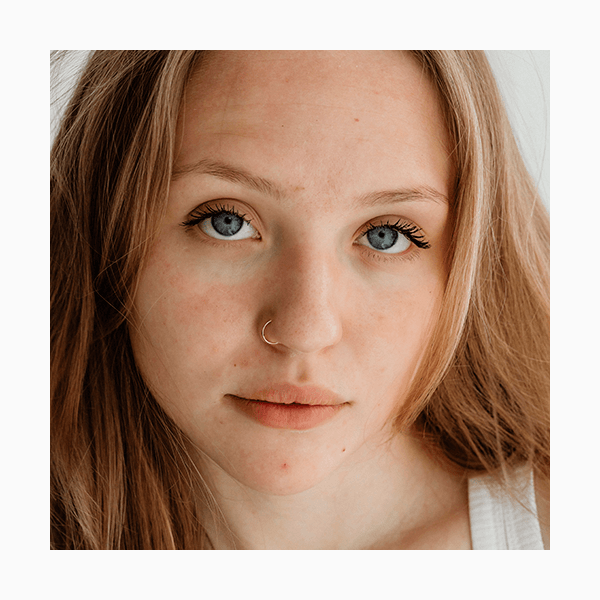 Остановитесь! Как бьюти-энтузиазм может разрушить кожный барьер