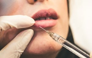 Что нельзя делать после увеличения губ