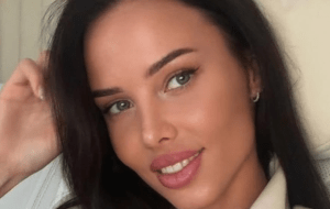 Анастасия Решетова поделилась, почему решила отказаться от уколов красоты