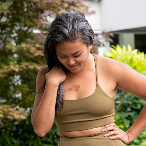 почему рано седеют волосы